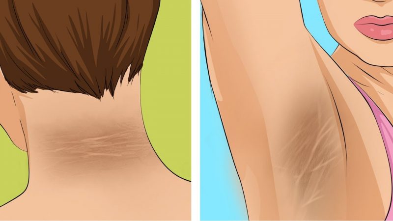 10 Early Signs Of Diabetes You Should Be Careful On