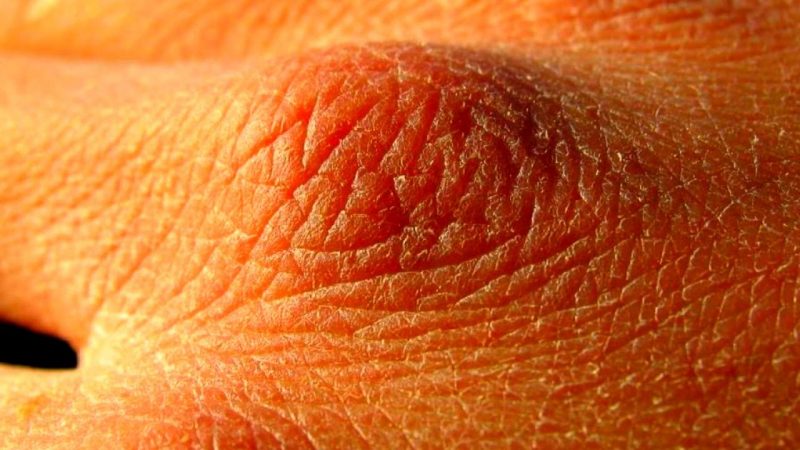 The Indications in your Body that you Do Not Drink Enough Water